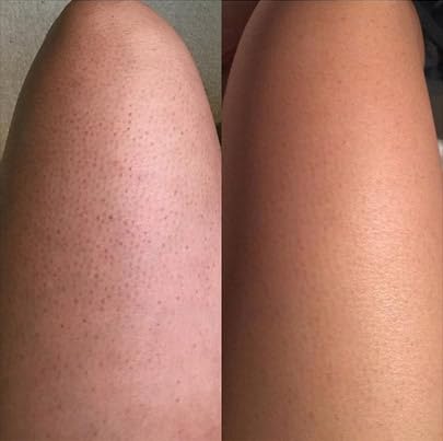 Radiant Glow Sugar Scrub - Natural Exfoliation & Moisturizer, Unveil Your Skinβs Natural Beauty, 8oz