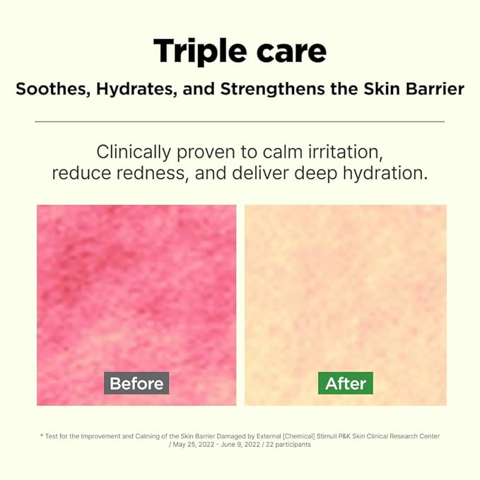ISOI Moisture Dr. Soothing Duo - Tea Tree Ceramide Toner & Light Cream for Sensitive Skin, Korean Skincare