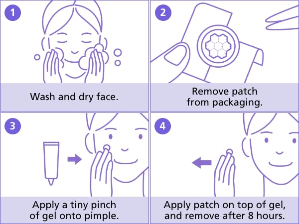 EasyDerm Magnesium Pimple Patches β Hydrocolloid Acne Spot Treatment with Ampoule & Tweezer, 10 Calming Zit Stickers by Daewoong, μ΄μ§λ€, λμ
μ μ½