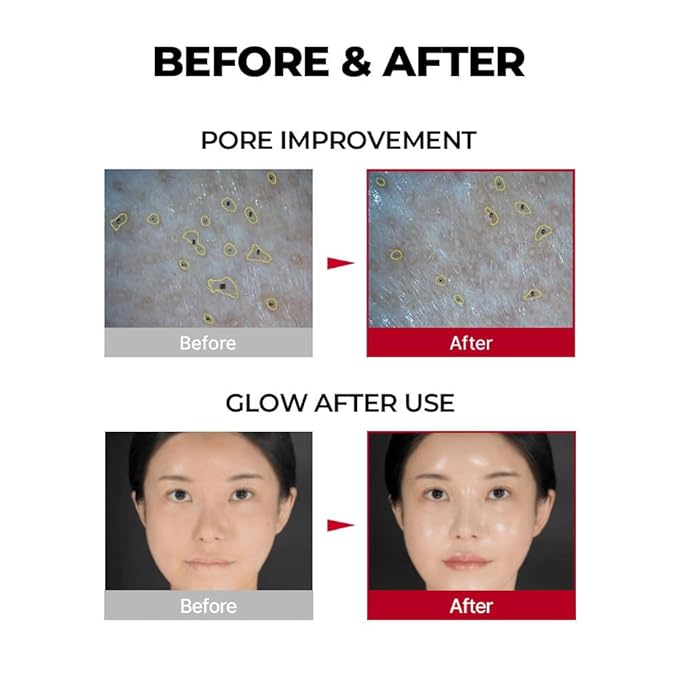 MDP+ Must Have Item Ultimate Collagen Booster Set for Neck and Face Wrinkles and Saggy Skin