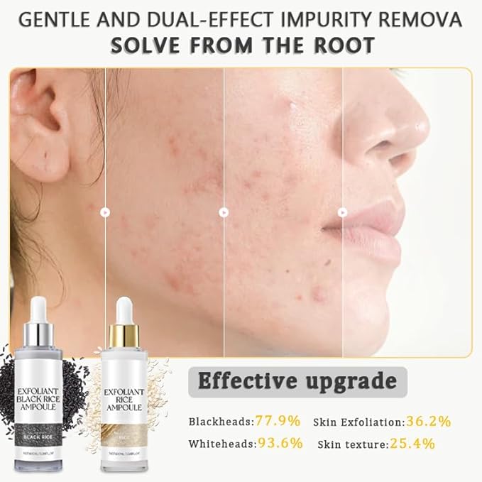 2PCS Rice Exfoliating Ampoule Set, 2025 Upgrade Black & White Rice Peeling Duo for Glowing Skin | Gentle Exfoliant + Pore Minimizing Serum + Deep Hydration & Hyaluronic Acid