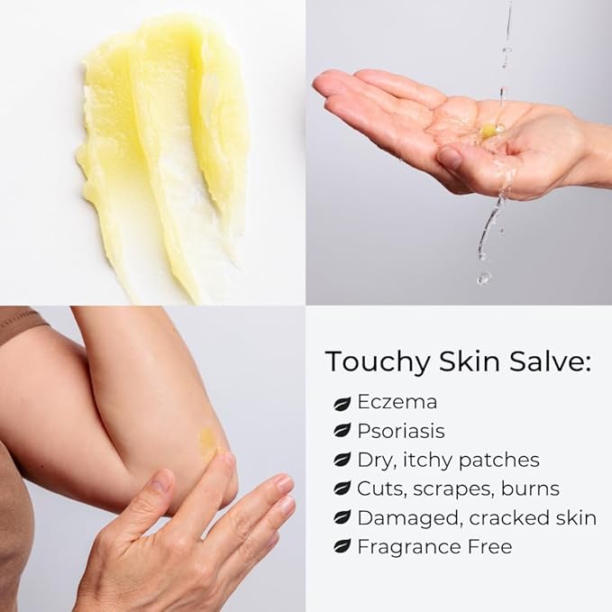 Touchy Skin Salve, Eczema Cream for Kids and Adults, Natural Sensitive Skin Treatment, Itch Cream, Calendula Ointment, 4 oz