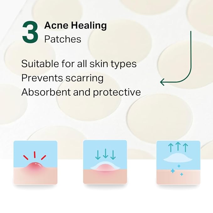 YβOUR Essential 3-Step Acne Kit: Purifying Cleanser, Anti-Acne Serum & Healing Patches; Pimple Clearing, Pore Minimizing Skincare Routine. Made in USA. Suitable for All Skin Types
