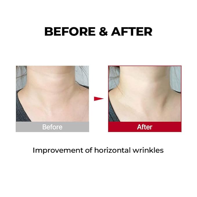 MDP+ Must Have Item Ultimate Collagen Booster Set for Neck and Face Wrinkles and Saggy Skin