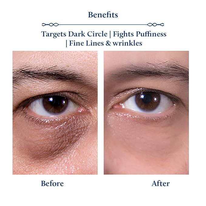 Blue Nectar Shubhr Under Eye Cream for Dark Circles with Papaya, Potato Starch & Niacinamide | Best Under Eye Cream for Men | Eye Cream for Dark Circles & Wrinkles (18 Herbs,15g)