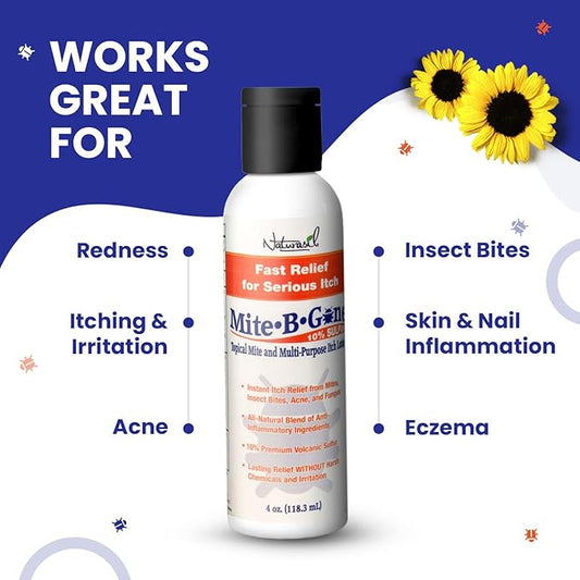All-Natural Itch Relief by Mite-B-Gone - Sulfur Lotion Treatment for Acne, Bug Bites, Skin Redness & Itching, Discomfort & Rosacea | Safe for Kids and Adults| Fast & Effective for All Skin Types| 4 oz