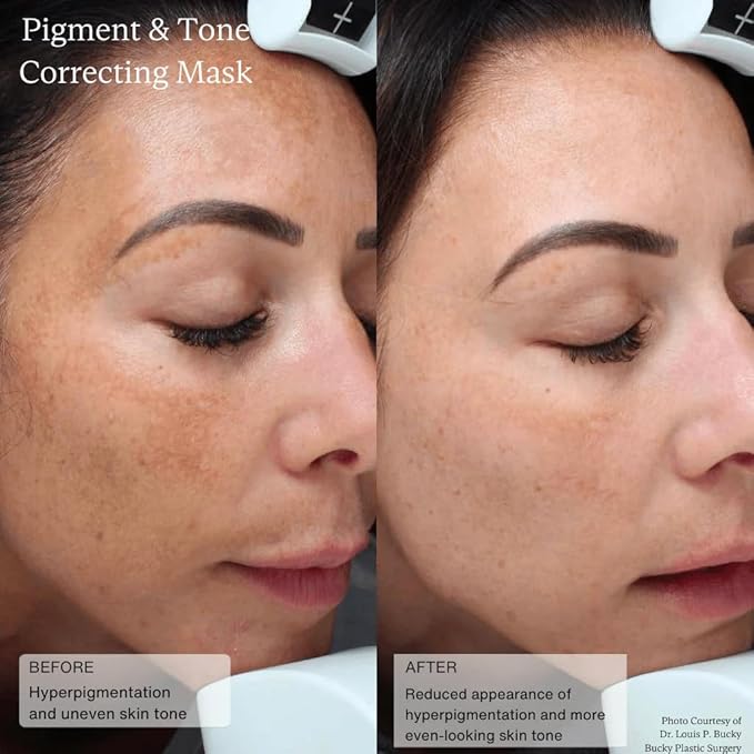 SentΓ© Cysteamine HSA Pigment and Tone Corrector- Hyperpigmentation Treatment For Reducing The Appearance of Dark Spots And Improving Skin Tone - 1.7 Fl Oz