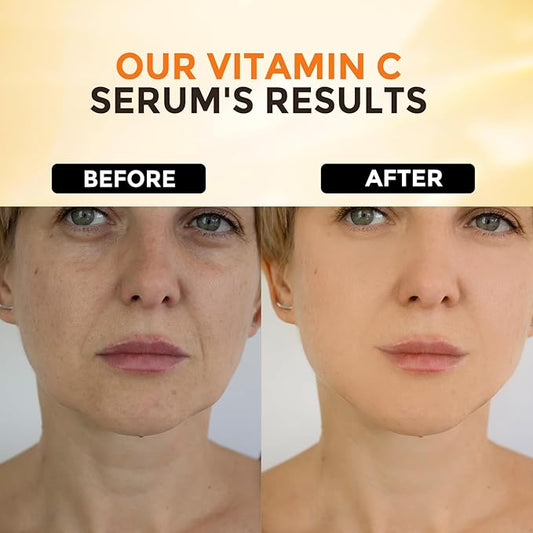 2 Packs Vitamin C Serum for Face βAnti Aging Face & Eye Serum, Hyaluronic Acid, Reduce Fine Lines, Dark Spots and Wrinkle