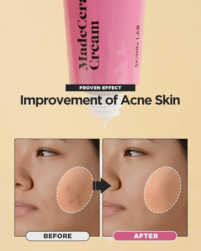 SKINRxLAB Made Cera Cream - Acne & Redness Relief Face Moisturizer, Sebum Control, Improving Skin Barrier with Ceramide and Madecassoside, Anti-Aging and Pore Minimizing Face Cream, 1.69 fl.oz.