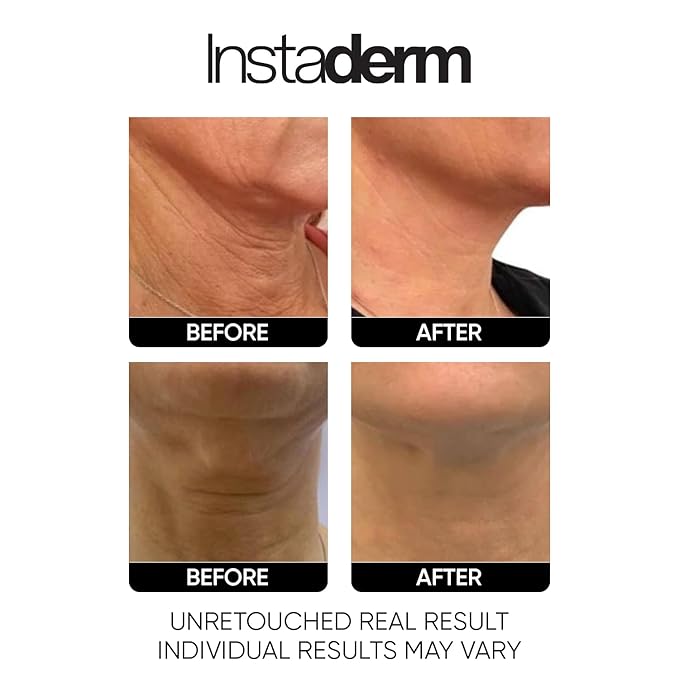 Neck and Décolleté Firming Craem – Tightening & Lifting Treatment for Crepey, Wrinkles, sagging Skin & Vertical Lines. Anti-Aging Peptide Formula to Boost Hydration & Collagen in the Skin.