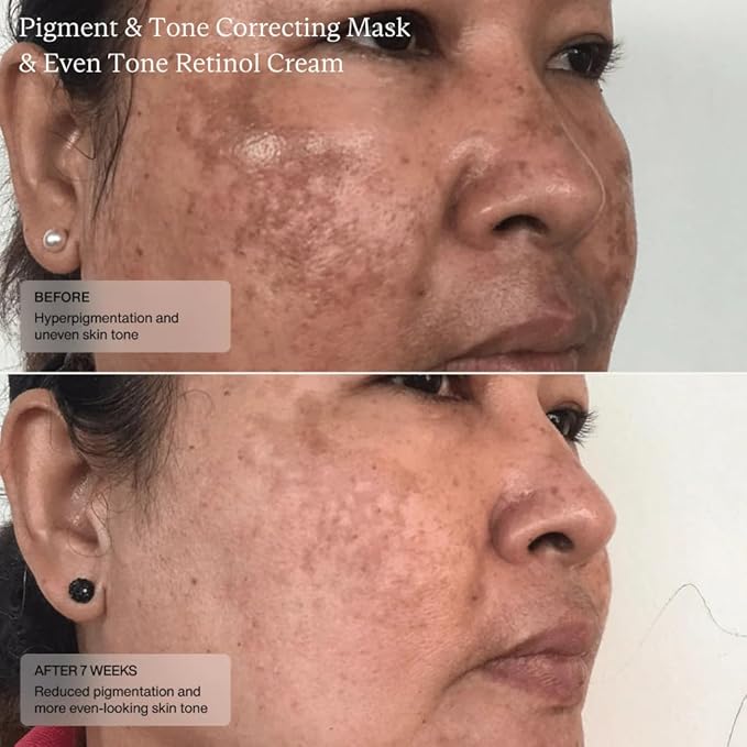 SentΓ© Cysteamine HSA Pigment and Tone Corrector- Hyperpigmentation Treatment For Reducing The Appearance of Dark Spots And Improving Skin Tone - 1.7 Fl Oz