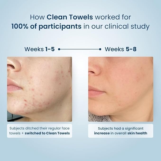 Clean Skin Club Clean Towels XLβ’, 100% USDA Biobased Face Towel, Disposable Face Towelette, Eczema Association Accepted, Makeup Remover Dry Wipes, Ultra Soft, 200 Ct, 4 Pack