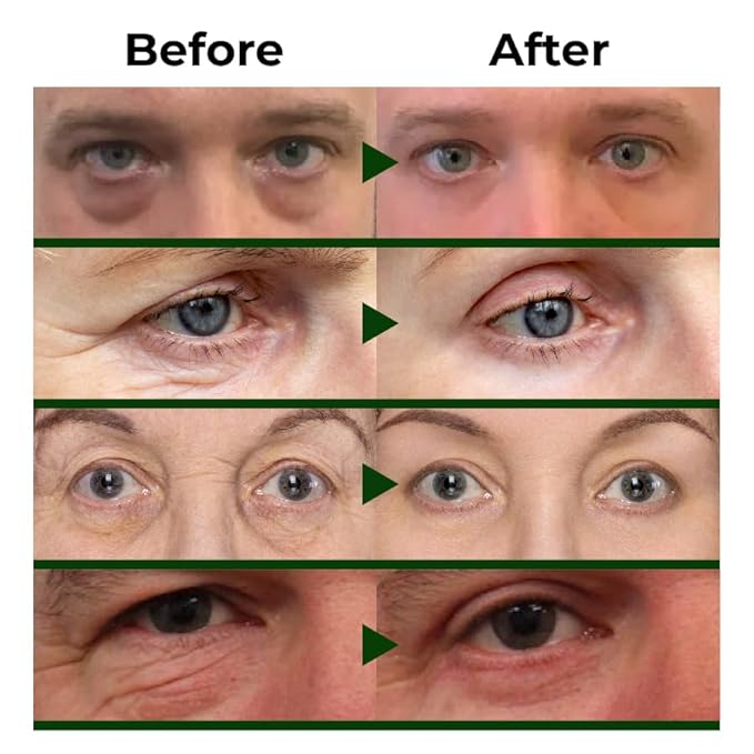 Abera Eye Roller Serum for Men β Refreshing Under-Eye Treatment for Puffiness, Dark Circles & Bags β With Mint, Peptides & Vitamin C β 0.34 fl.oz, 2 Box + Gift