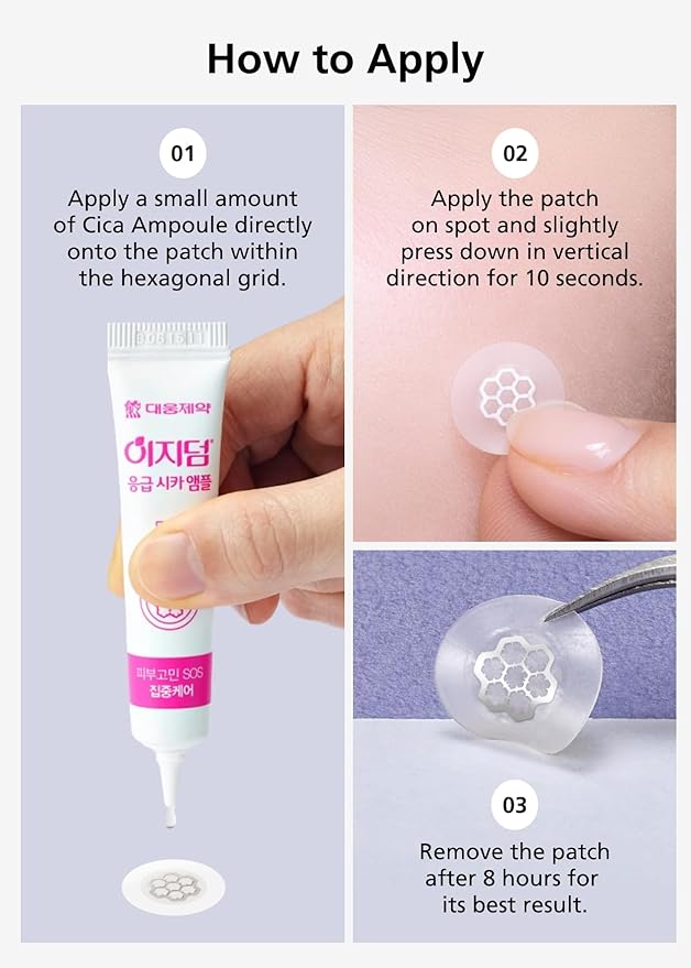 EasyDerm Quick Calming Magnesium Patches β Hydrocolloid Acne Spot Treatment Includes Tweezers & Ampoule, 10 Patches, Zit Sticker, TikTok Viral Blemish Patch, Made by Daewoong Pharmaceutical