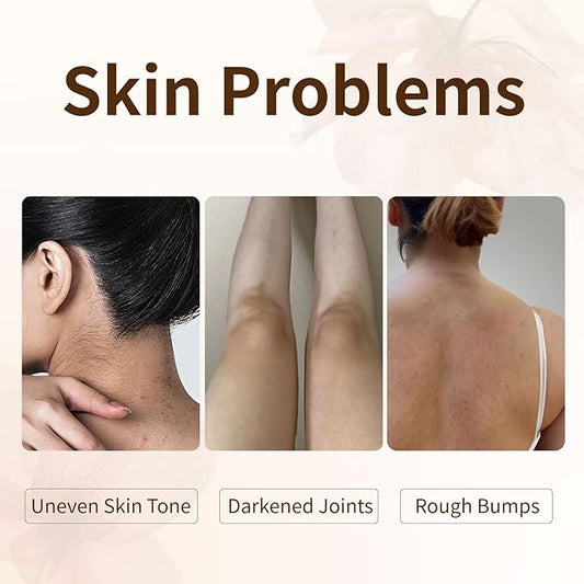 5% Niacinamide Exfoliating Body Scrub for Women - Rose Scrub with Niacinamide, Rose Oil and Seal Salt - Hydrating & Smooths Skin, Suitable for Sensitive Skin - Best for Mother's Day- 8.82oz