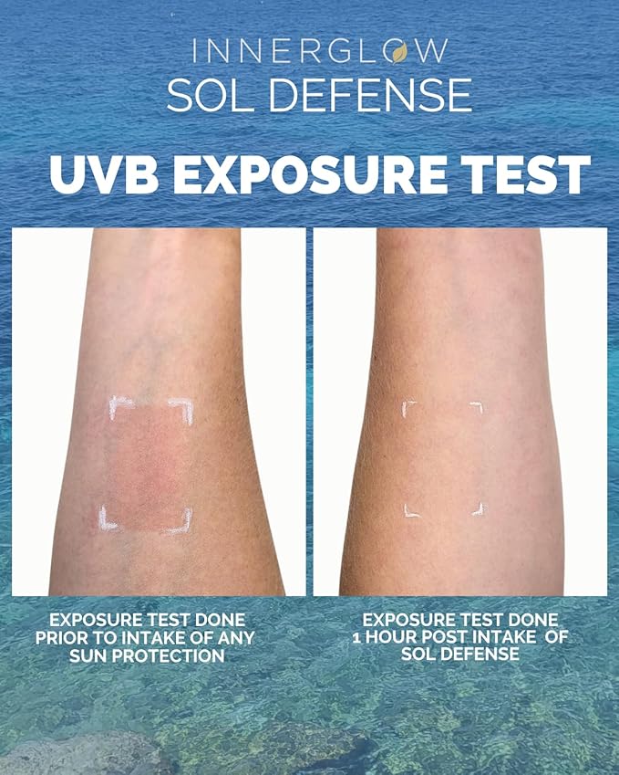 Sol Defense Gummies β Dermatologist & Plastic Surgeon-Formulated Skin Resilience Vitamin Supplement with Polypodium Leucotomos & Niacinamide, Passion Fruit Flavor, 60 Sugar-Free Gummies