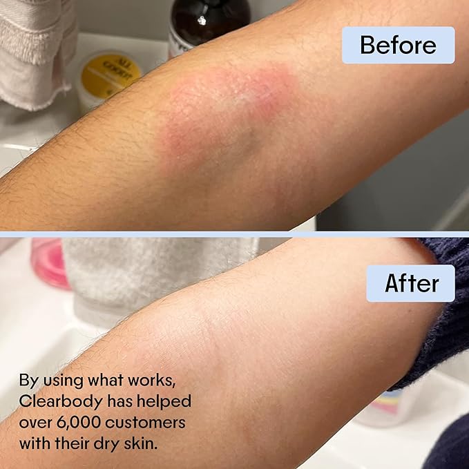 Clearbody Manuka Honey Eczema Cream β Organic Eczema Honey & Collodial Oatmeal Moisturizer for Soothing, eczema, Dry & Itchy Skin β Face & Body Lotion - Plant-Based Formula (2oz)