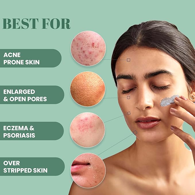 Wild Oak De Tan & Anti Acne Clay Mask | With 7x Power of Niacinamide, Bamboo Charcoal, Ashwagandha, Calendula, Manjistha & Licorice | Glow and Oil Control | Blackheads | Face Pack | 3.52 Oz