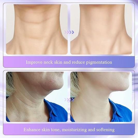 2Pcs Neck Collagen Cream-Collagen Firming Lifting Neck Cream,Face & Neck Collagen Cream,Firm and Lift Sagging Skin