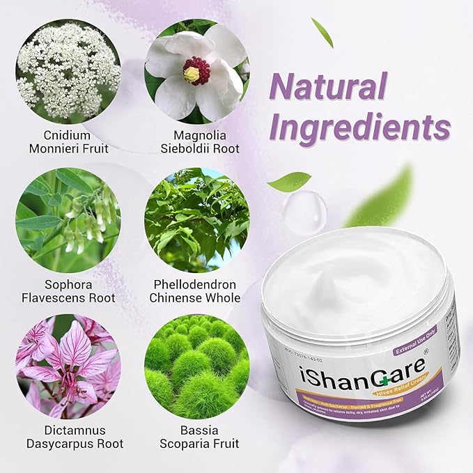Urticaria Cream, Fast Acting Relief of Hives, Allergic Rashes, Itchy Skin, Redness, Swelling, Anti Fungal Hives Cream with All Natural Herbal Ingredients, 3.53 Oz