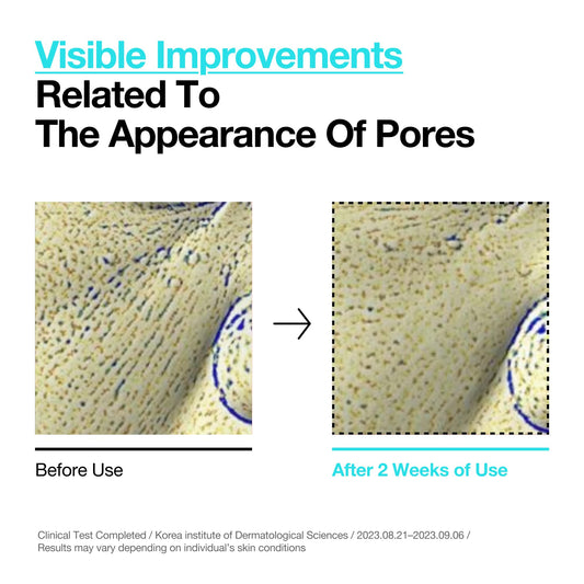 ANUA BHA 2% Gentle Exfoliating Toner, Mild Facial Exfoliant, Salicylic Acid for Pores and Sebum, Teatree Extract, Hyaluronic Acid, Ceramides (150ml / 5.07 fl.oz.)