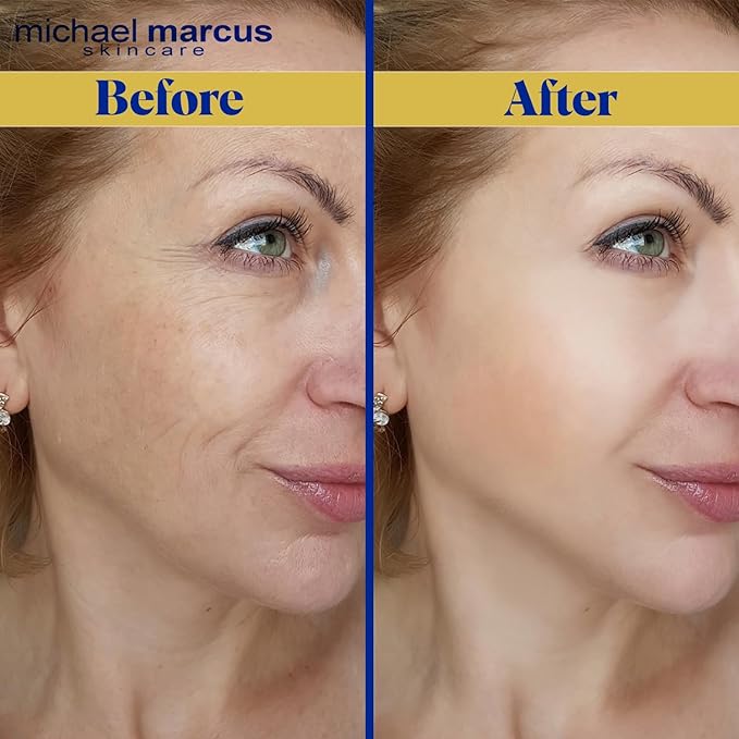 Michael Marcus Anti Fatigue Eye Masque (1 Fl oz) - Eye Cream for Puffy Eyes, Dark Circles, and Wrinkles - Moisturizing for Men & Women â Natural, Hydrating & Cruelty Free Eye Skincare