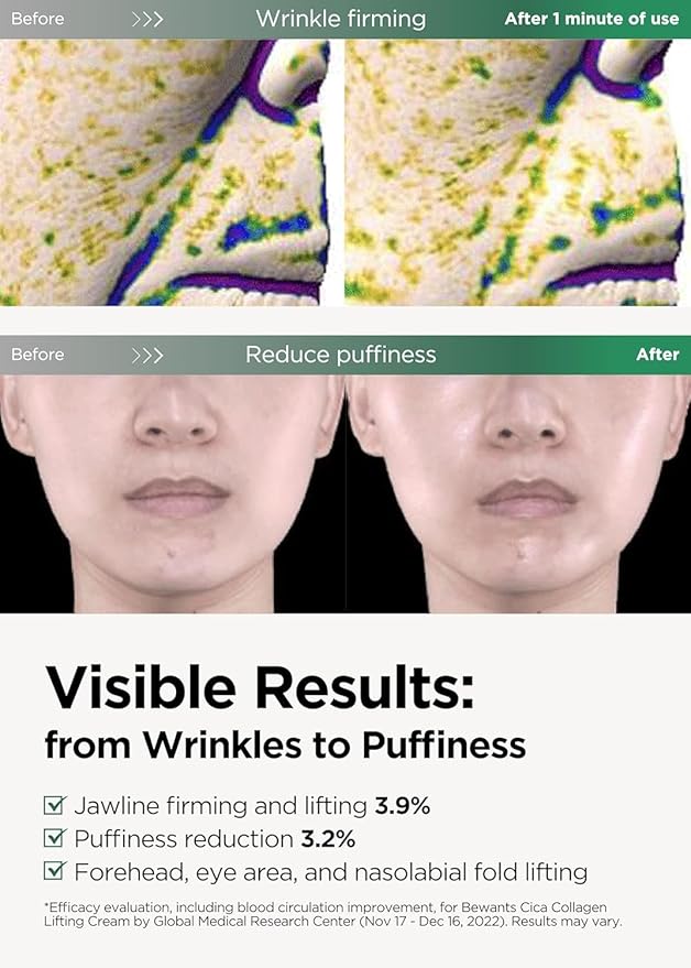 Bewants Guasha Neck Cream, Lifting & Firming Moisturizer with Centella Asiatica & Vegan Hyaluronic Acid β Includes RABIE Rabbit Edition with Smartphone Grip (1 Pack)
