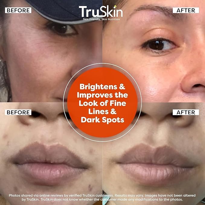 TruSkin Vitamin C Serum For Face β Anti Aging Face Serum with Vitamin C, Hyaluronic Acid, Vitamin E β Brightening Formula β Improve Appearance of Dark Spots, Tone, Fine Lines & Wrinkles, 1 Fl Oz