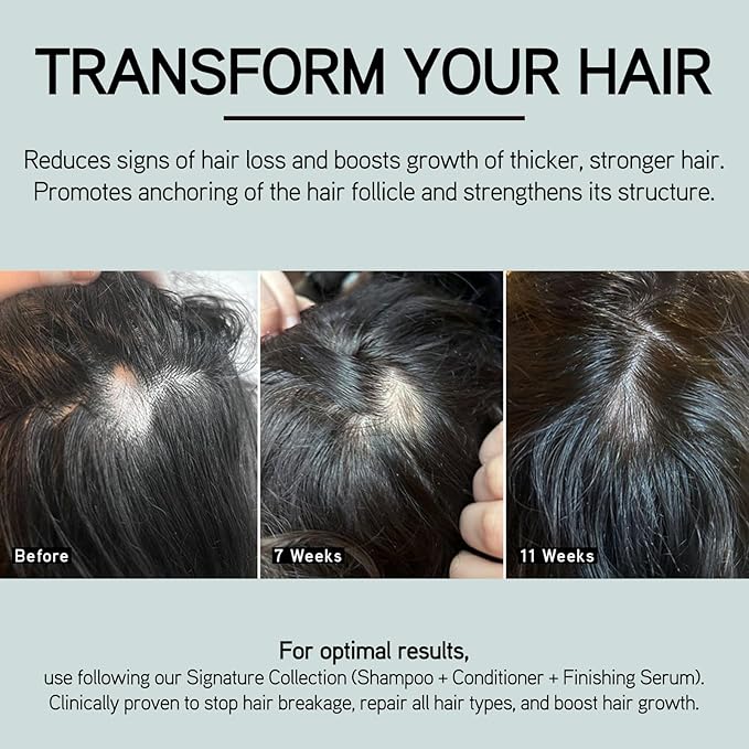 ILES FORMULA Scalp & Hair Rejuvenating Booster β Reduces Hair Loss Signs, Boosts Growth & Thickness, Botanically Derived Breakthrough Blend with Procapil, Tomato, Apple & Wasabi Extracts (1.7 Fl Oz)