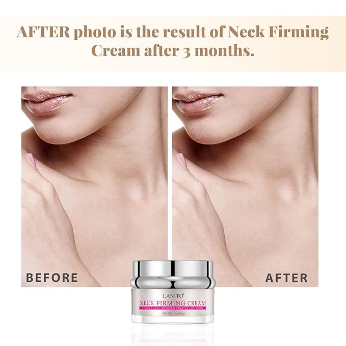 Newly Upgraded Neck Firming Cream with Wrinkle-Smoothing, Anti Aging Skin Tightening Cream for Womanβs Neck Wrinkles Treatment