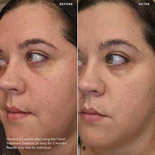 SK-II Facial Treatment Essence - Anti-Aging Essence Skincare to Help Reduce the Appearance of Fine Lines & Wrinkles - Visibly Refines Texture & Improves Firmness & Dark Spots (7.7 oz)