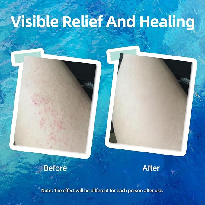 Natural Soothing Eczema Cream With Sea Moss Aloe Vera Oats for Multiple Skin Types Comfort Moisture Hydrate Eczema Cream for Dry Skin 4FL Oz