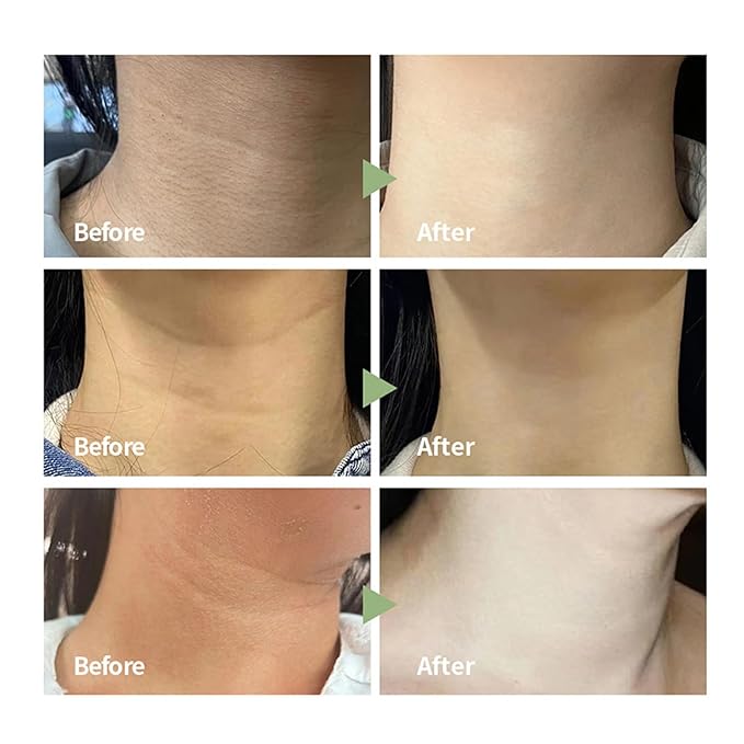 Tighten and Lift Neck Cream,Advanced Anti-aging Neck Cream,Even Skin Tone,Hydrate and Smooth Neck,Hydrating Neck Cream for Fine lines, Loose & Sagging Skin On Face,Neck