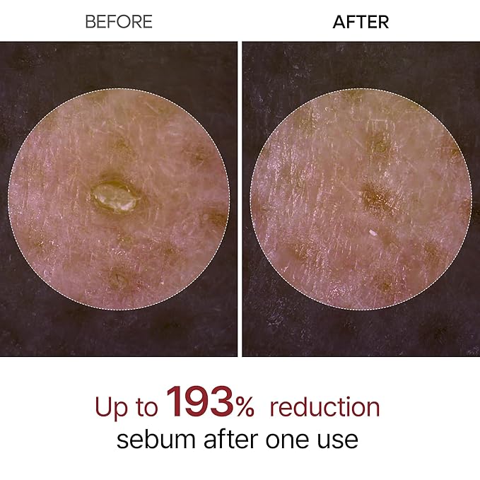 Peel Shot Glow Black Rice Peeling Ampoule, Soft Exfoliating Face and Body Scrub Dead Skin Cells, Blackheads Remover for All Skin Types korean skin care 80ml