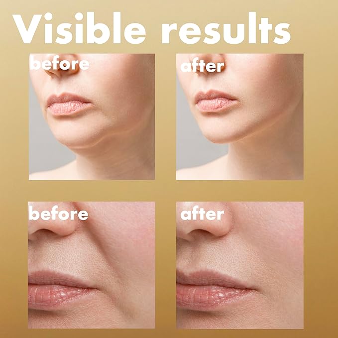 ISOI Intensive Lifting Serum, Premium Hydrating Serum for Skin Elasticity & Firmness, Daily Lifting Care for Face & Neck, Korean Skin Care (1.18 fl. oz, 35ml)