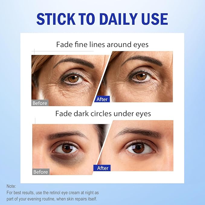 Retinol Eye Cream, Hydrating Under Eye Care Daily Wrinkle Cream,123456789