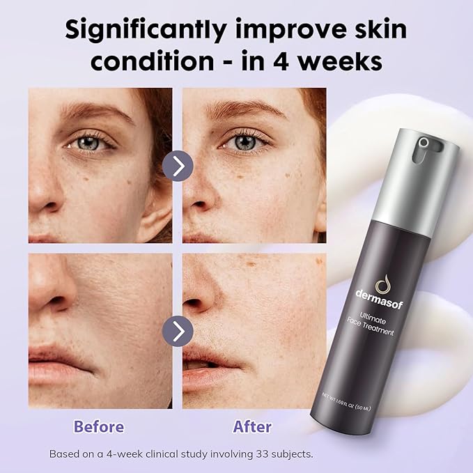 Face Moisturizing Lotion with Active Peptides & Vitamin C, Anti-Aging Antioxidant Advanced Formula, Smooth Wrinkles, Firming, Brightening, Soothes Redness, Repair, Hydrate Skin, 1.69 Fl Oz
