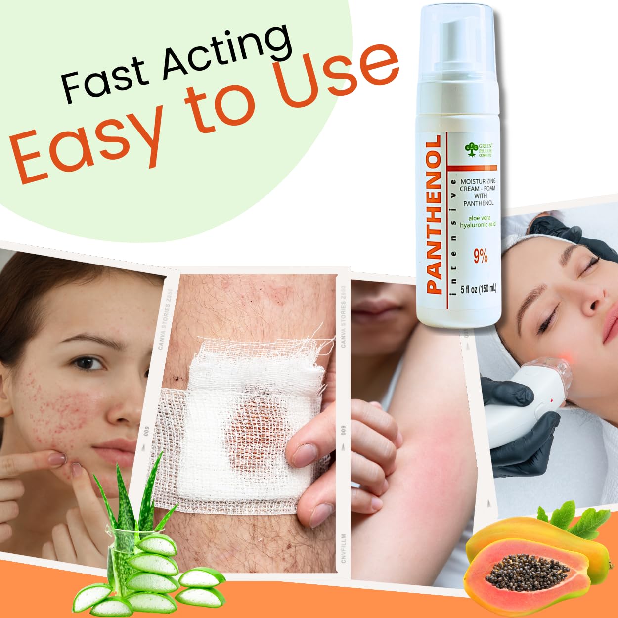 9% Panthenol Foam Spray - Redness Relief Moisturizer | Acne, Burn & Skin Repair with Aloe & Hyaluronic Acid β Post-Laser, Stitches, Tattoo & Hair Transplant, 5Oz