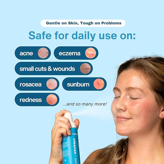 Hypochlorous Acid Spray β HOCl Face & Body Mist for Acne, Eczema & Irritation β Multi-Purpose Skin Repair β Eyelid Cleanser, Post-Workout/Procedure, Scalp & Sensitive Skin (2 oz+6.8 oz)
