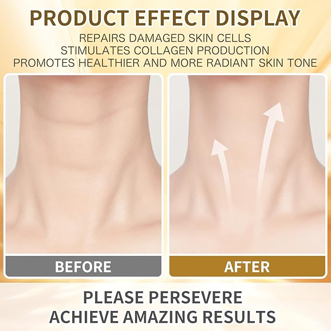 Anti Aging Firming Neck Cream, 5-IN-1 Face Tighten and Lift Neck Cream, Anti Wrinkle Neck Retinol & Collagen Cream, Chest Neck & Face Lifting|Repairing|Moisturzing Skin Care for Men & Women(1.7 OZ)