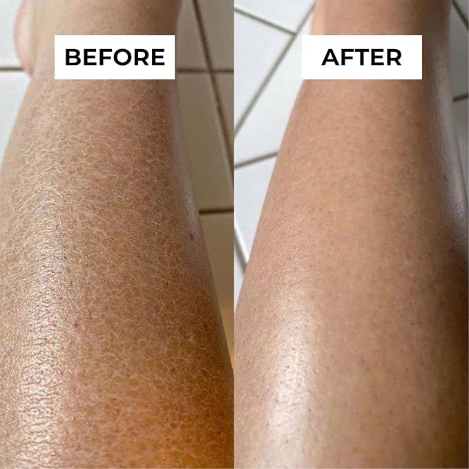Exfoliating Glove for Body β 100% Natural Viscose | Dead Skin Remover for Silky Smooth & Glowing Skin | Deep Exfoliation Mitt