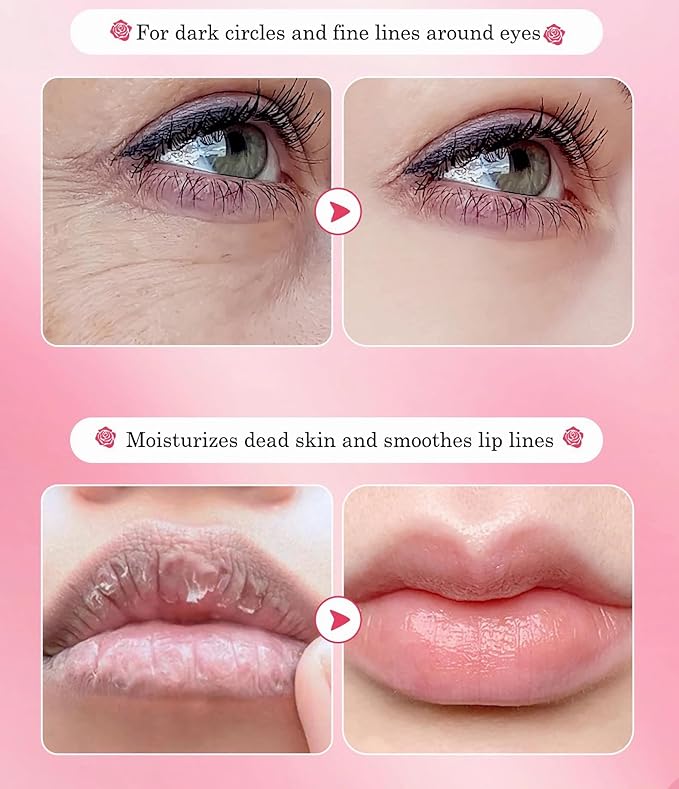 10 Pair Under Eye Mask & 10 Pair Lip Mask Skincare Set, Rose Pink Lip Patches & Under Eye Patches for Puffy Eyes, Dark Circles, Dry Lips Lines, Deep Hydrating Moisturizing, Gifts for Mom Women