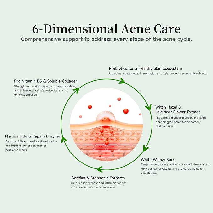 Gentle Botanical Acne Treatment for Face β Acid-Free Spot Facial Serum with Niacinamide & Witch Hazel, Soothes Redness & Controls Breakouts for Sensitive, Oily & Acne-Prone Skin β 1.2 ml Γ 30 Ampoules