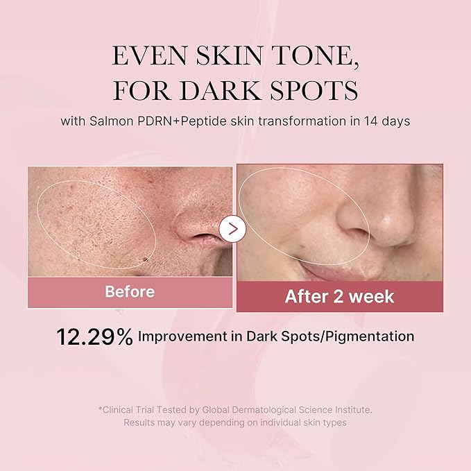 medicube Salmon DNA PDRN Pink Trio Set: Salmon DNA PDRN Pink Peptide Serum and Salmon DNA PDRN Pink CICA Soothing Toner and Salmon DNA PDRN pink collagen jelly gel mask (4ea)
