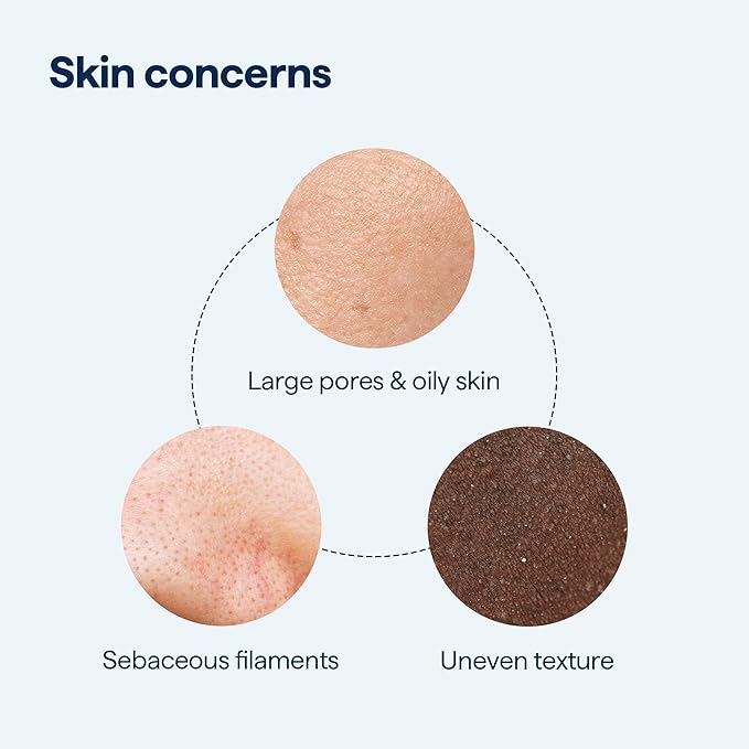 Remedy for Pore Size β Large Pore Minimizer with Retinol, BHA Salicylic Acid, Niacinamide β for Uneven Texture, Pimples, Blackheads, Whiteheads, Sebaceous Filaments β by Dermatologist Dr. Shah