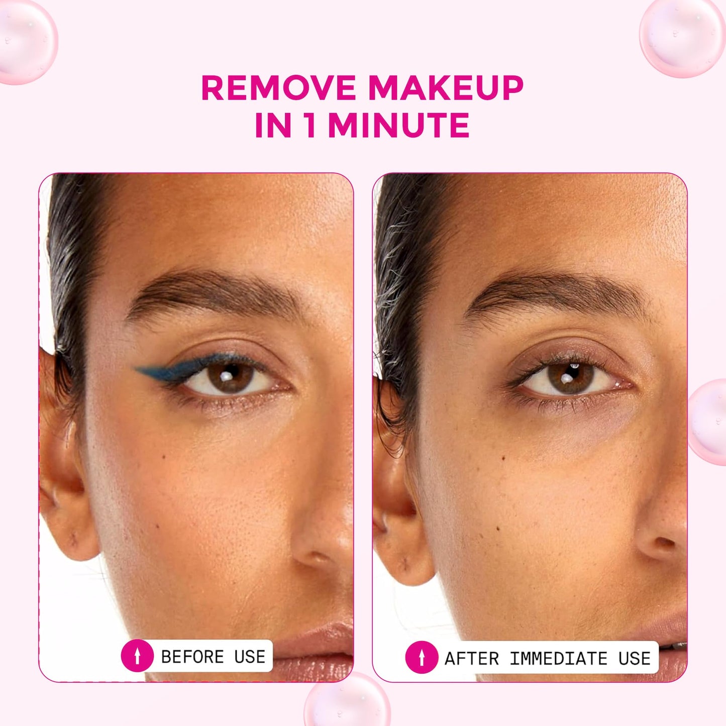 Belitaas Vitamin C Face Wash 6.76 fl oz (200ml) | 2% Salicylic Acid & 5% Aloe Vera | Deep Cleansing & Acne Control | SLS-Free, Plant-Based Formula, with Honey & Vitamin E | For All Skin Types, Vegan