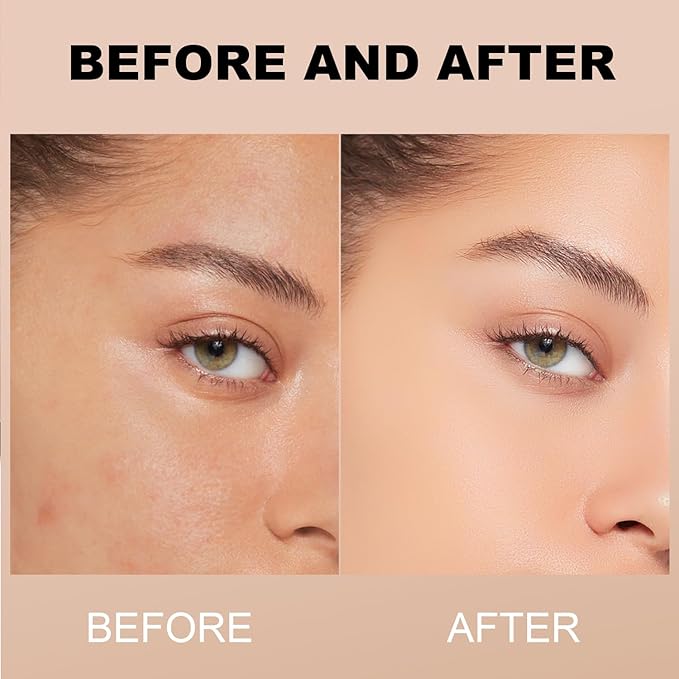 YOUNG VISION Full Coverage Liquid Foundation and Concealer Duo β Long-Wear, Lightweight, Non-Comedogenic, Hydrating, Oil-Free, Waterproof, Skin-Like Finish for All Skin Types