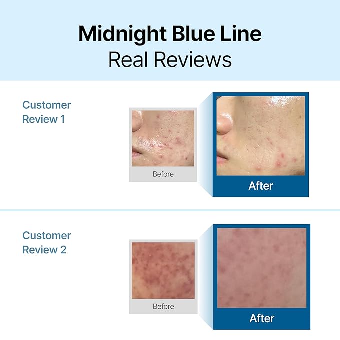DearKlairs Midnight Blue Calming Cream β Soothing Face Moisturizer for Oily & Sensitive Skin, Redness Relief & Hydrating, Lightweight Texture, 2 Fl Oz