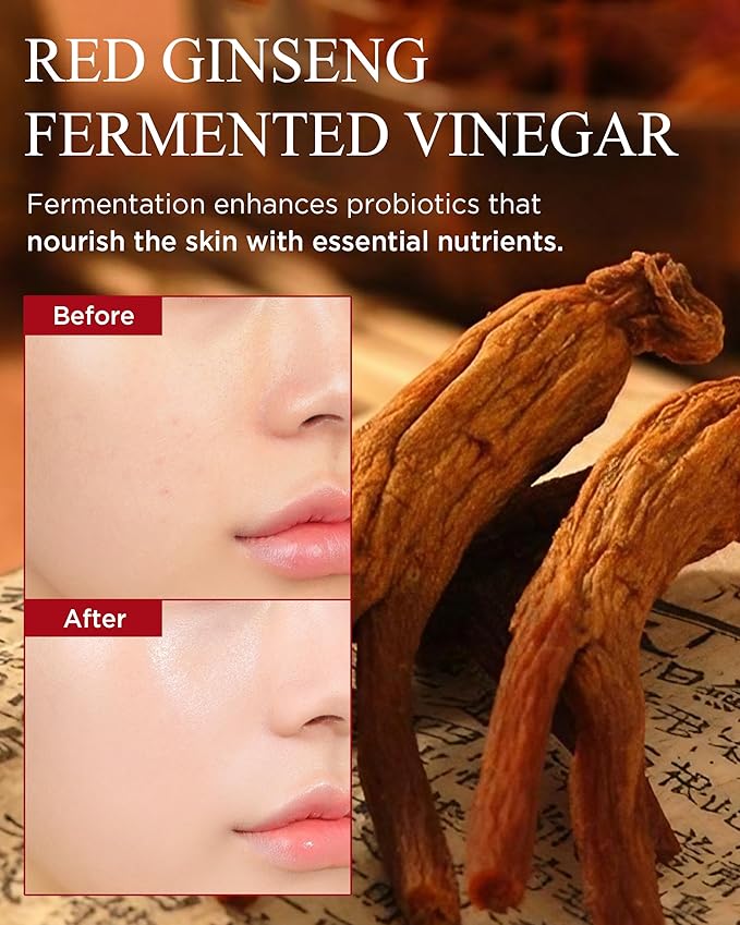Bonyongo Red Ginseng Vinegar Skin Toner β Refreshing & Moisturizing Face Toner for Smooth, Youthful Skin - with Fermented Red Ginseng - Korean Skincare, 5.07 fl.oz.