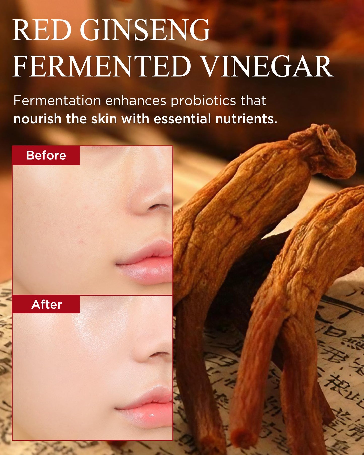 DANAHAN Bonyongo Red Ginseng Vinegar Skin Toner β Refreshing & Moisturizing Face Toner for Smooth, Youthful Skin - with Fermented Red Ginseng - Korean Skincare, 5.07 fl.oz.